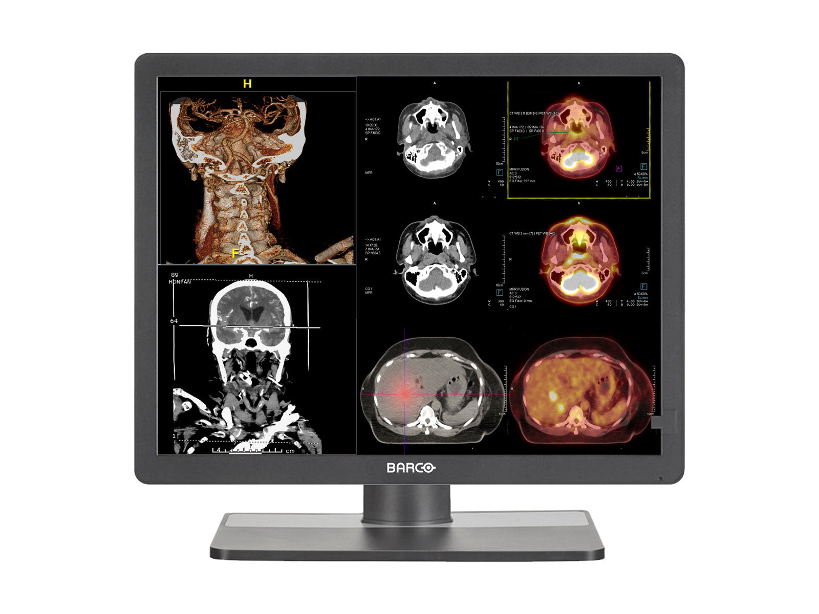 Barco Eonis MDRC-2321 2MP 21" Color Clinical Review Display Monitors.com 
