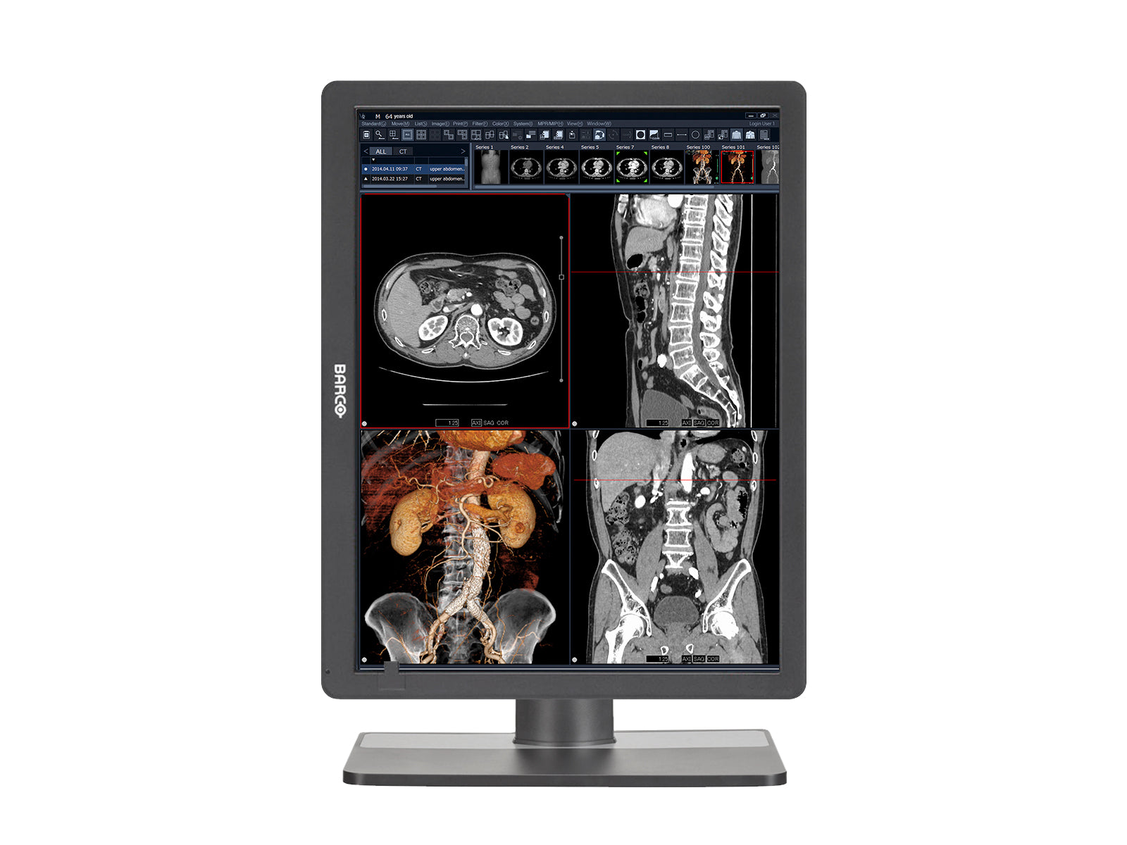 Barco Eonis MDRC-2321 2MP 21" Color Clinical Review Display Monitors.com 