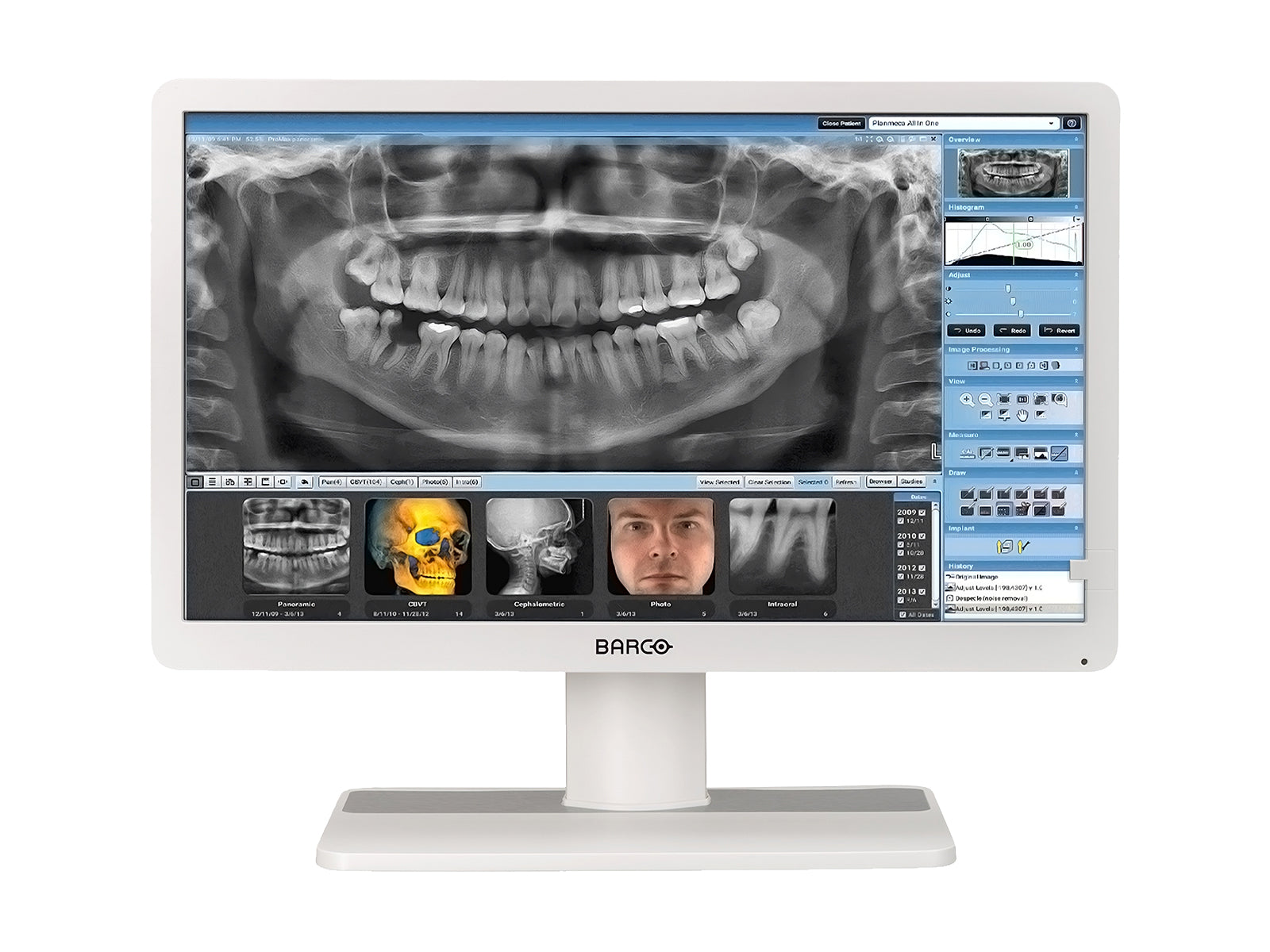 Barco Monitor LED de revisión clínica Eonis MDRC-2324 HNEW 2MP 24"