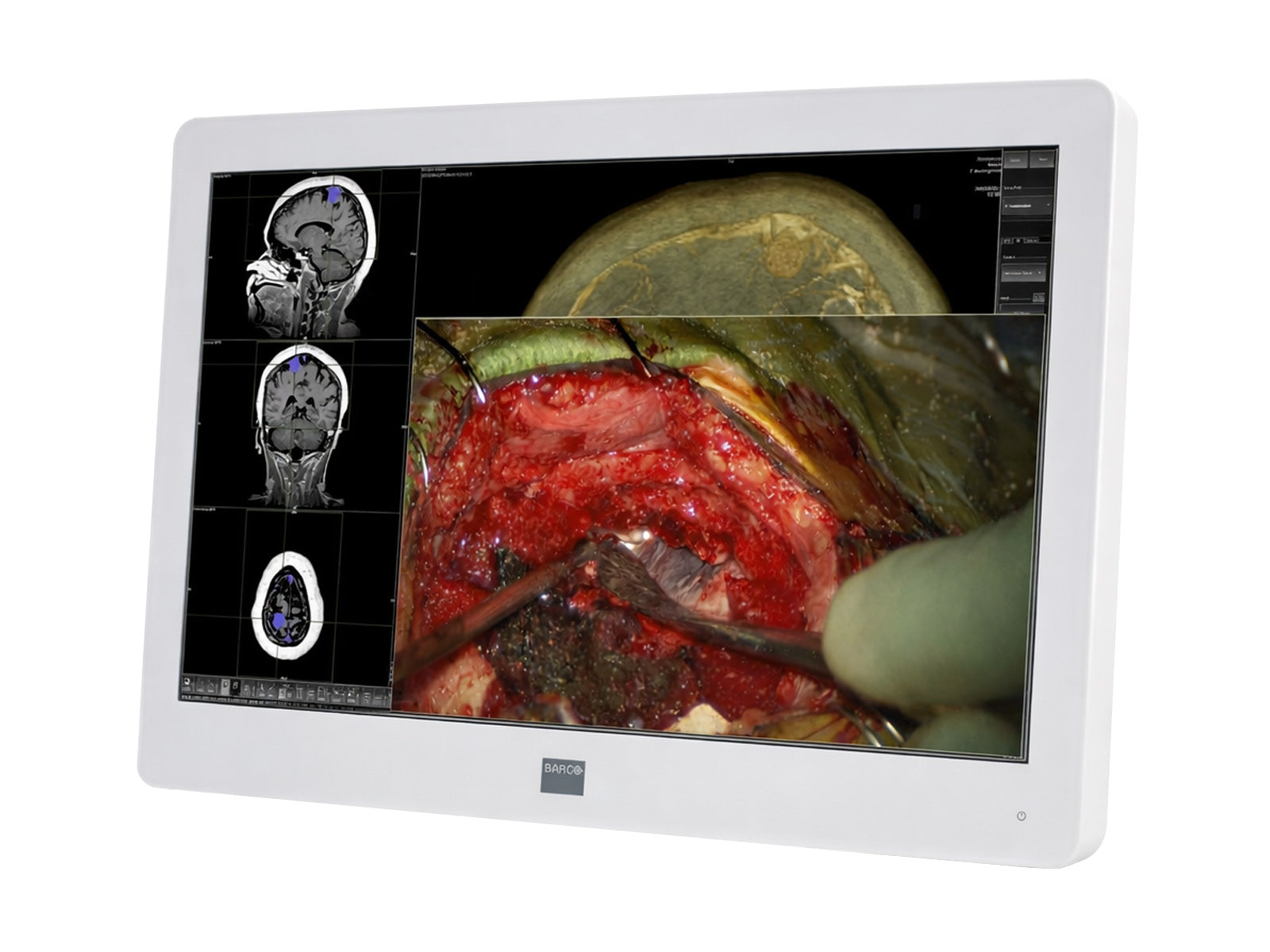 Barco MDSC-2224 24" 2MP FHD 1920 x 1200 Surgical Medical Display Monitor (K9307913)