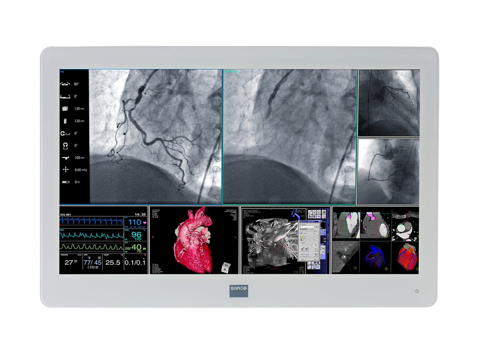 Barco MDSC-2226 LED 26" 2MP Full HD Surgical Medical Display Monitor (K9307906)