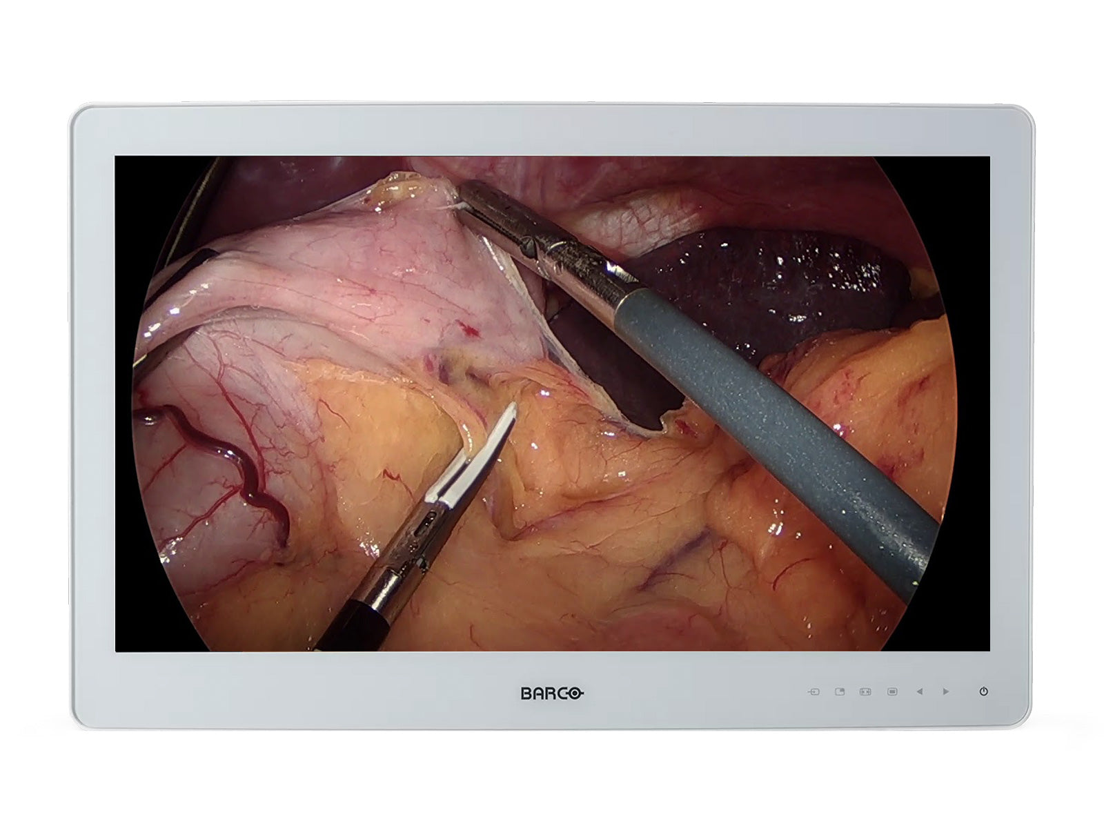 Barco MDSC-2326 LED 26" 2MP Full HD Surgical Medical Display Monitor (K9307951)