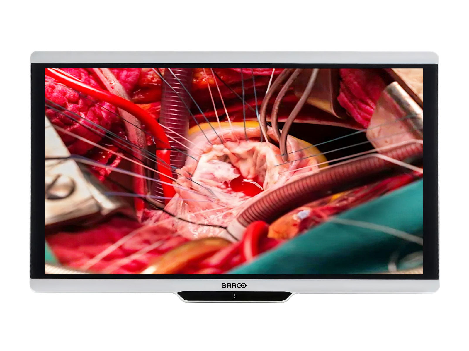 Barco MDSC-8427 LED 27" 8MP 4K UHD Color Surgical Medical Display Monitor (K9352052)