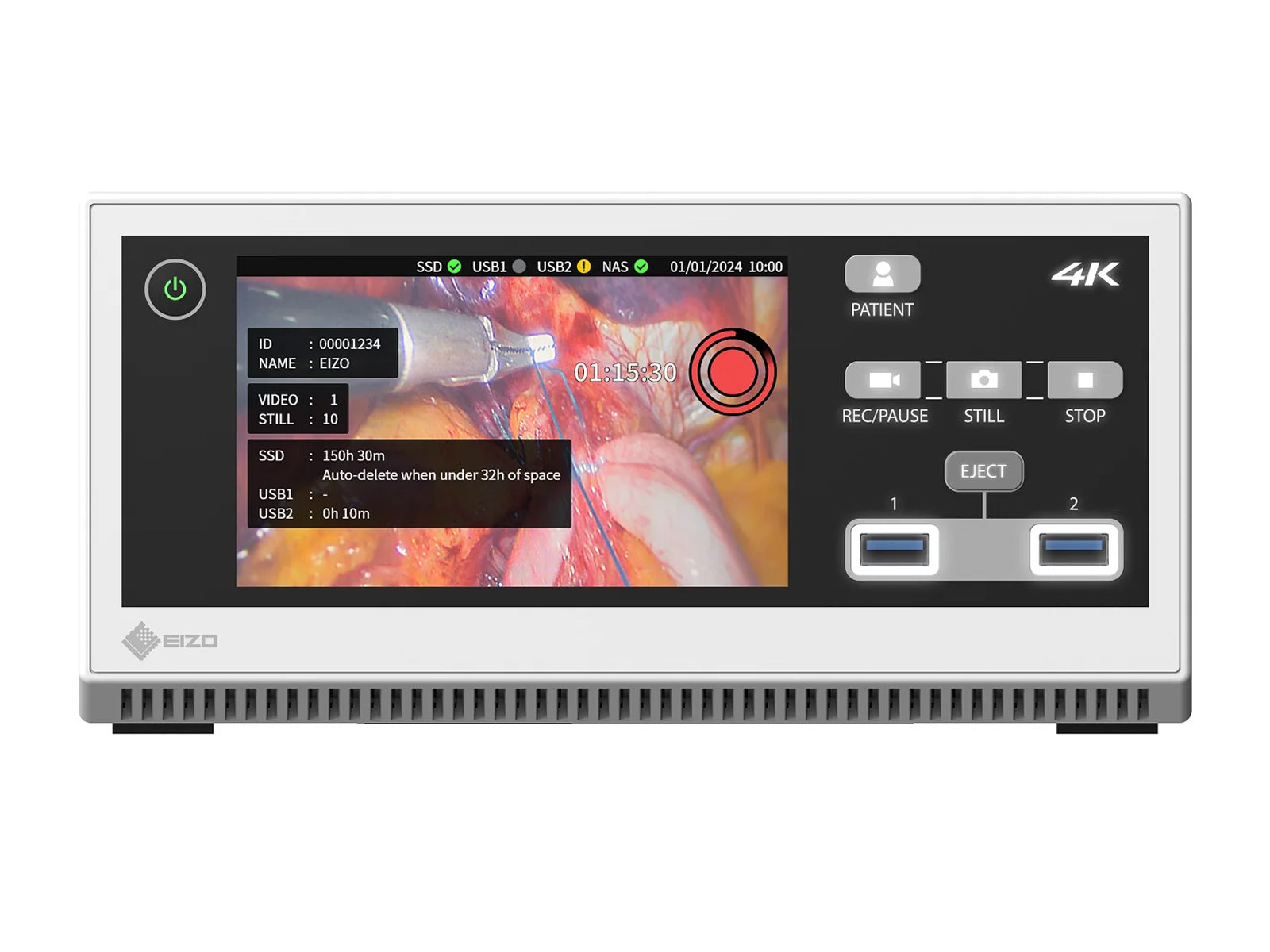 Eizo CuratOR MIR-1 4K/60p Recorder for Medical Images (MIR-1)