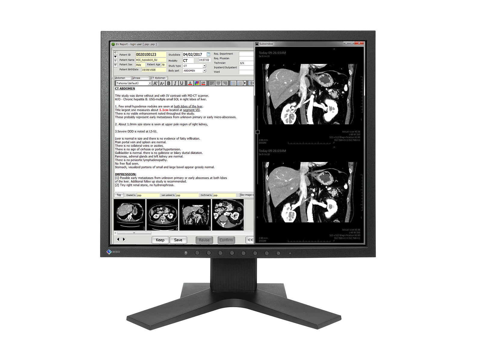 Eizo Radiforce MX194 1MP 19" Monitor per Revisione Clinica (MX194)