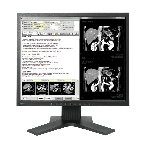 Eizo Radiforce MX194 19