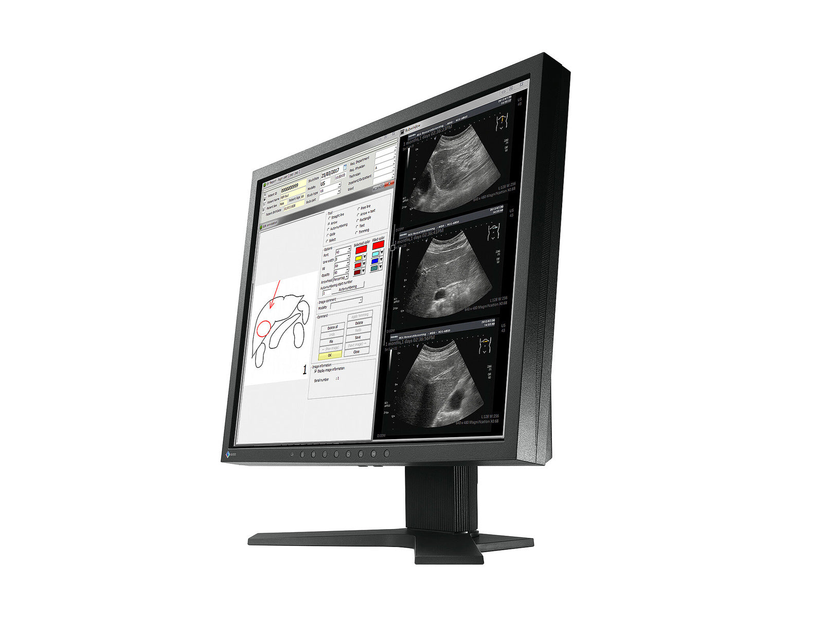 【新品未使用品】液晶モニターRadiForce MX194 EIZO ブラック Eizo Radiforce MX194 1MP 19