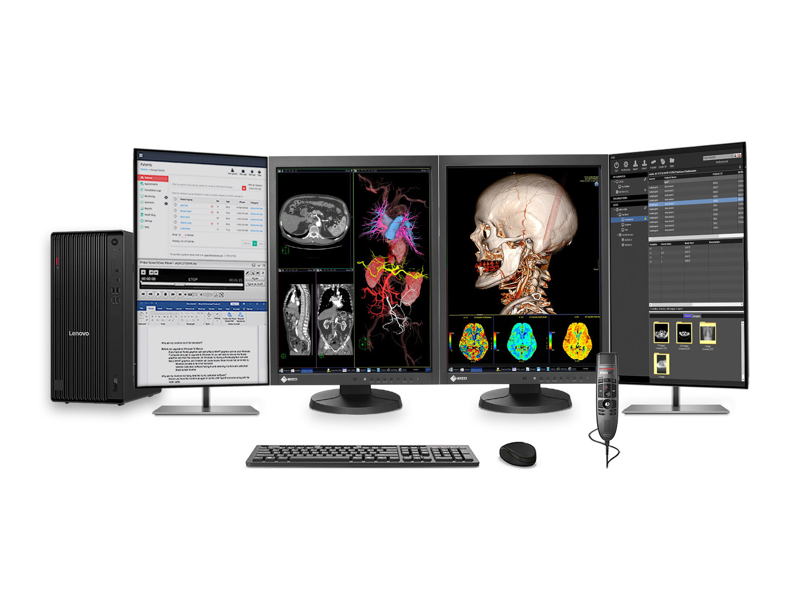 Stazione completa di Radiologia Generale PACS | Eizo Radiforce MX215 2MP Monitor a LED a Colori | Workstation Business Class | Microfono per Dettatura | Monitor Worklist (MX215Z2SFFG1i)