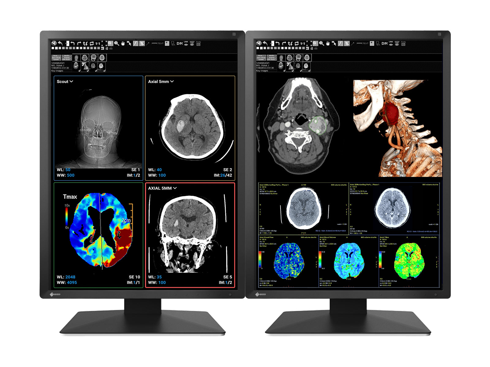 Eizo RadiForce MX217 2MP 21" Color LED Medical Display Monitor (MX217-BK)