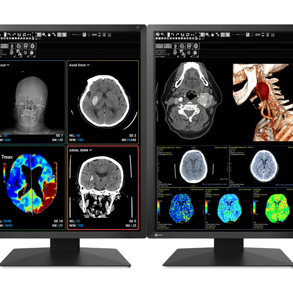 ⭐︎新品未使用 EIZO RadiForce MX217 モニター 2023年製 Eizo RadiForce MX217 2MP Medical Display Monitor