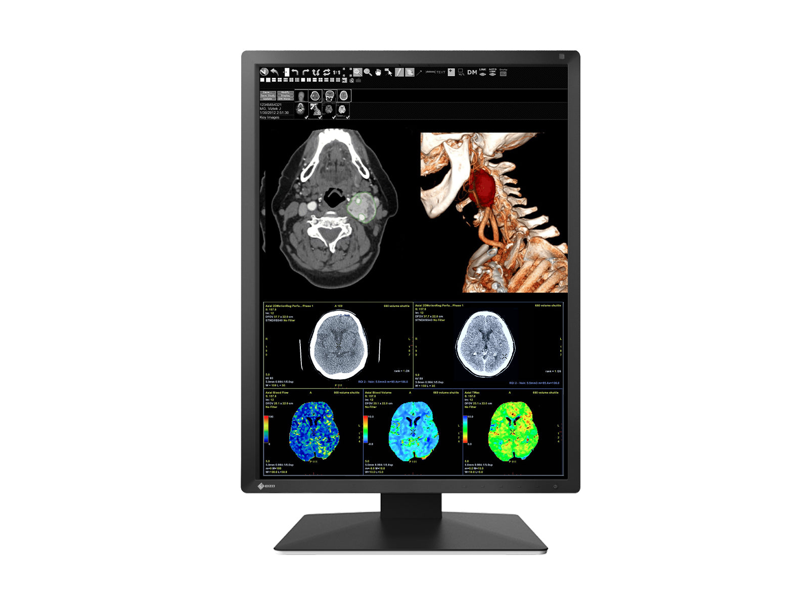Eizo RadiForce MX217 2MP 21" Color LED Medical Display Monitor (MX217-BK) Monitors.com 