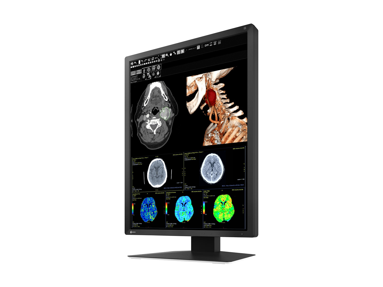 Eizo RadiForce MX217 2MP 21" Color LED Medical Display Monitor (MX217-BK) Monitors.com 