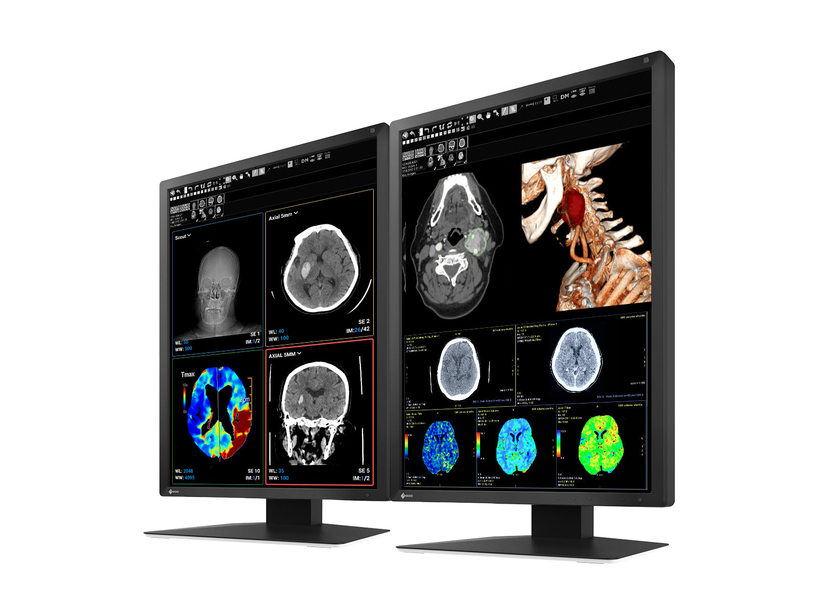Eizo RadiForce MX217 Monitor de pantalla médica LED en color de 2 MP y 21 "(MX217-BK)