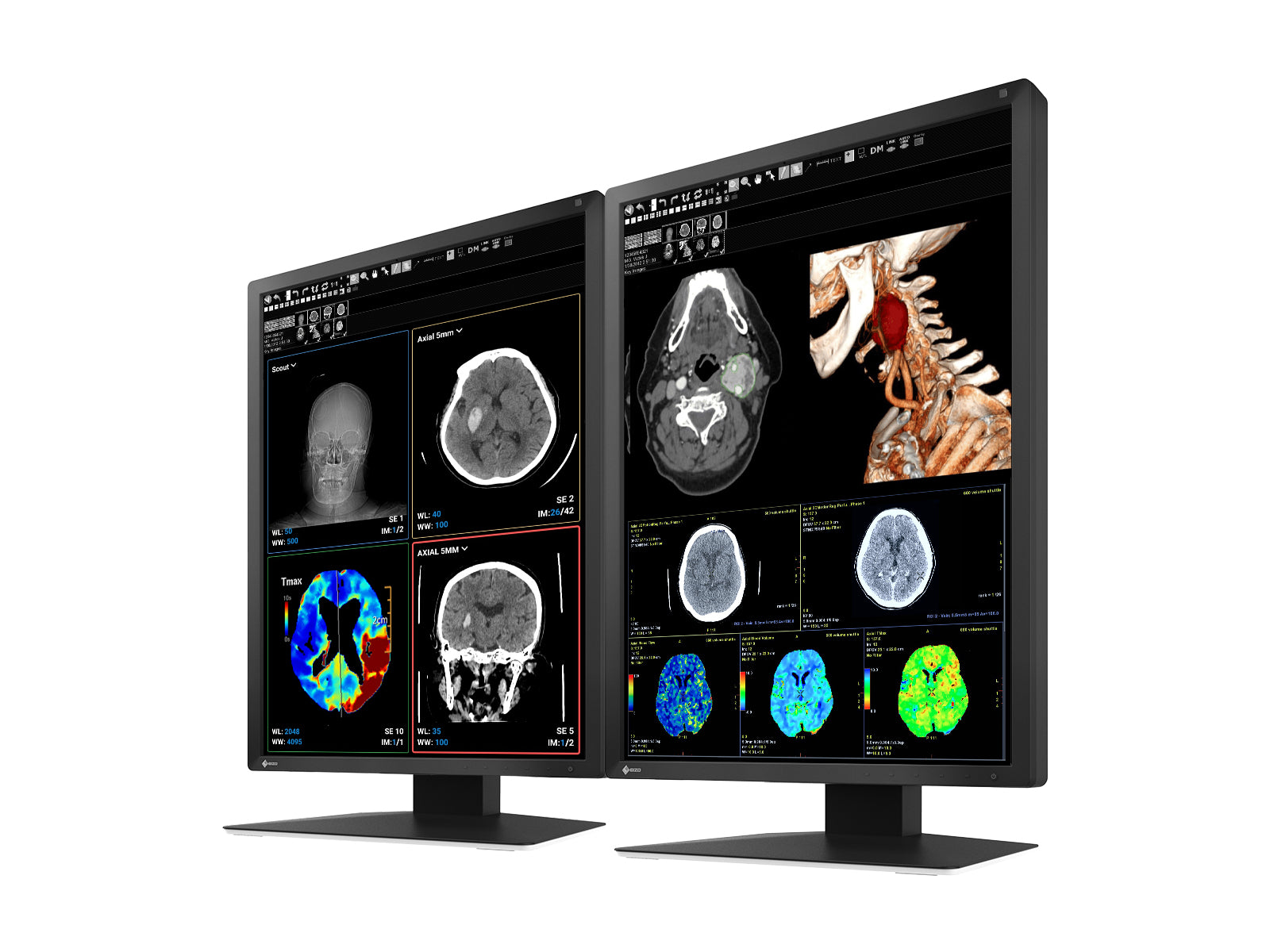 Eizo RadiForce MX217 2MP 21" έγχρωμη οθόνη οθόνης LED (MX217-BK)