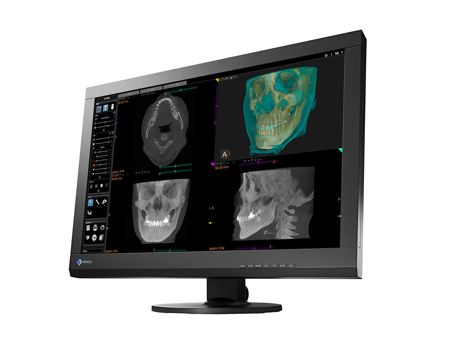 Eizo RadiForce MX242W 2.3MP 24" Color LED Clinical Review Display (MX242W-BK) Monitors.com 