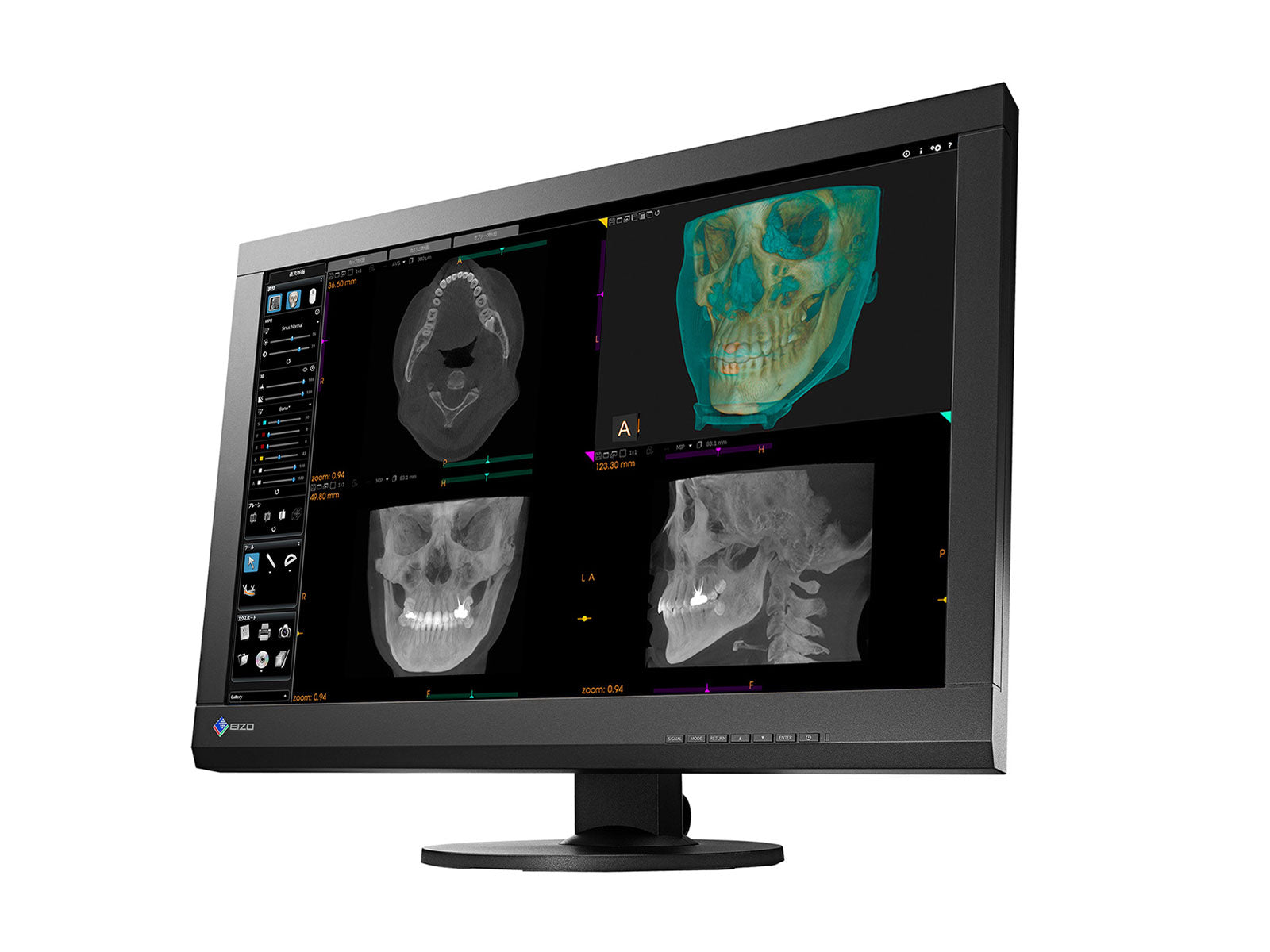 Eizo RadiForce MX242W 2.3 MP 24-Zoll-Farb-LED-Display für klinische Untersuchungen (MX242W-BK)