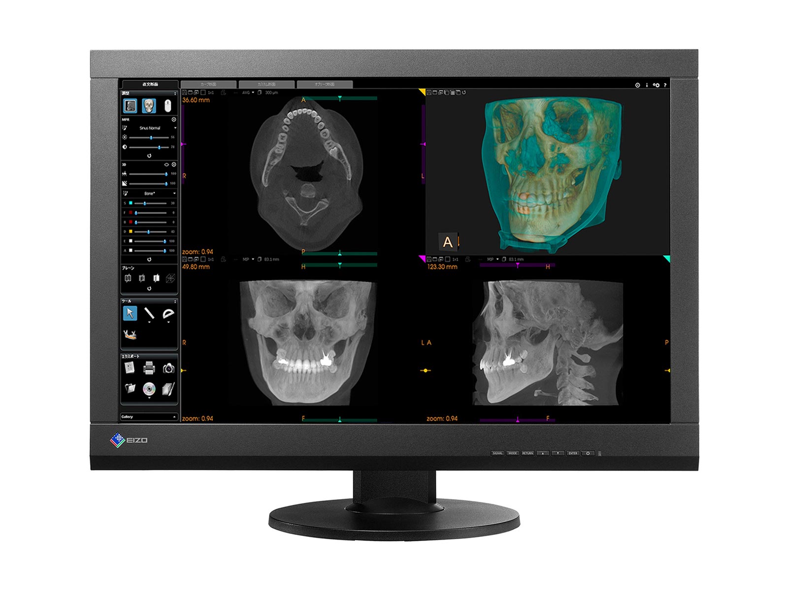 Eizo RadiForce MX242W 2.3MP 24" Color LED Clinical Review Display (MX242W-BK) Monitors.com 