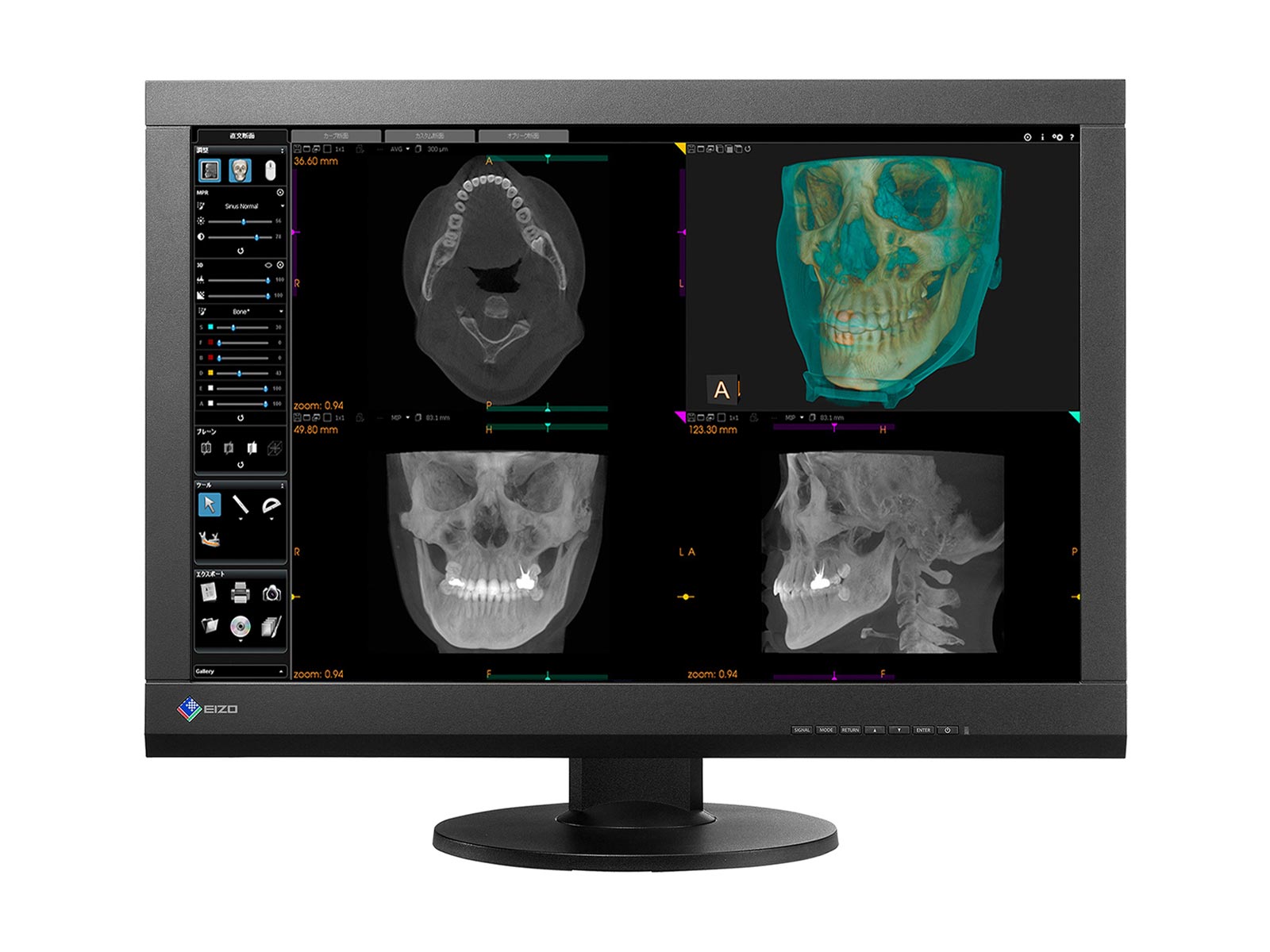 Eizo RadiForce MX242W Écran d'examen clinique LED couleur 2.3 MP 24" (MX242W-BK)