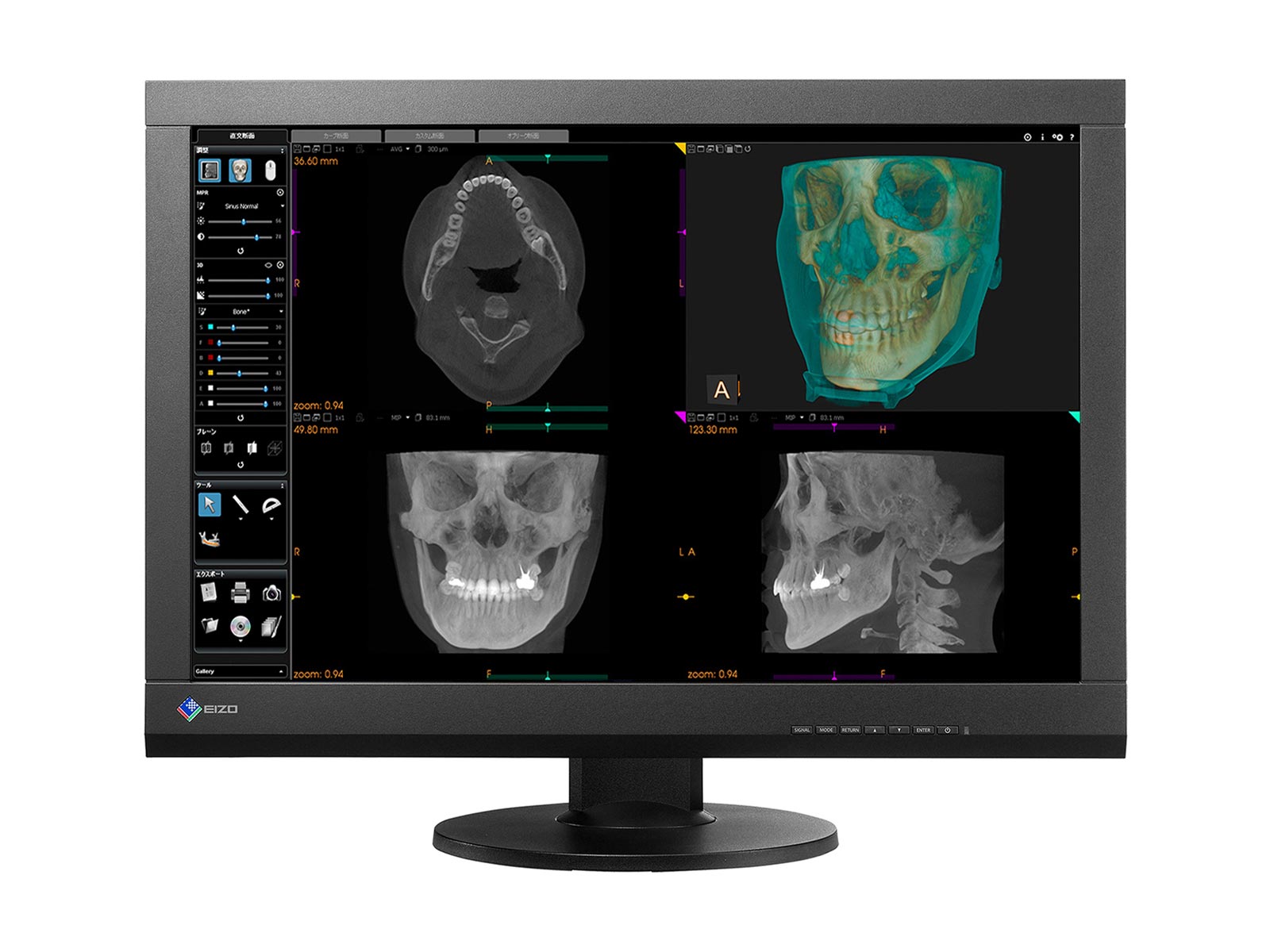 EIZO Radiforce MX242W – Moniteur 24,1″ TFT Couleur Clinique – Large écran Noir