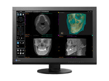 Eizo RadiForce MX242W 2,3MP 24" Écran d’examen clinique couleur (MX242W-BK)