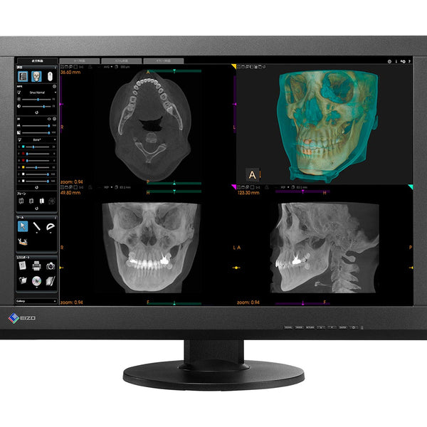 Eizo RadiForce MX242W 2.3MP 24