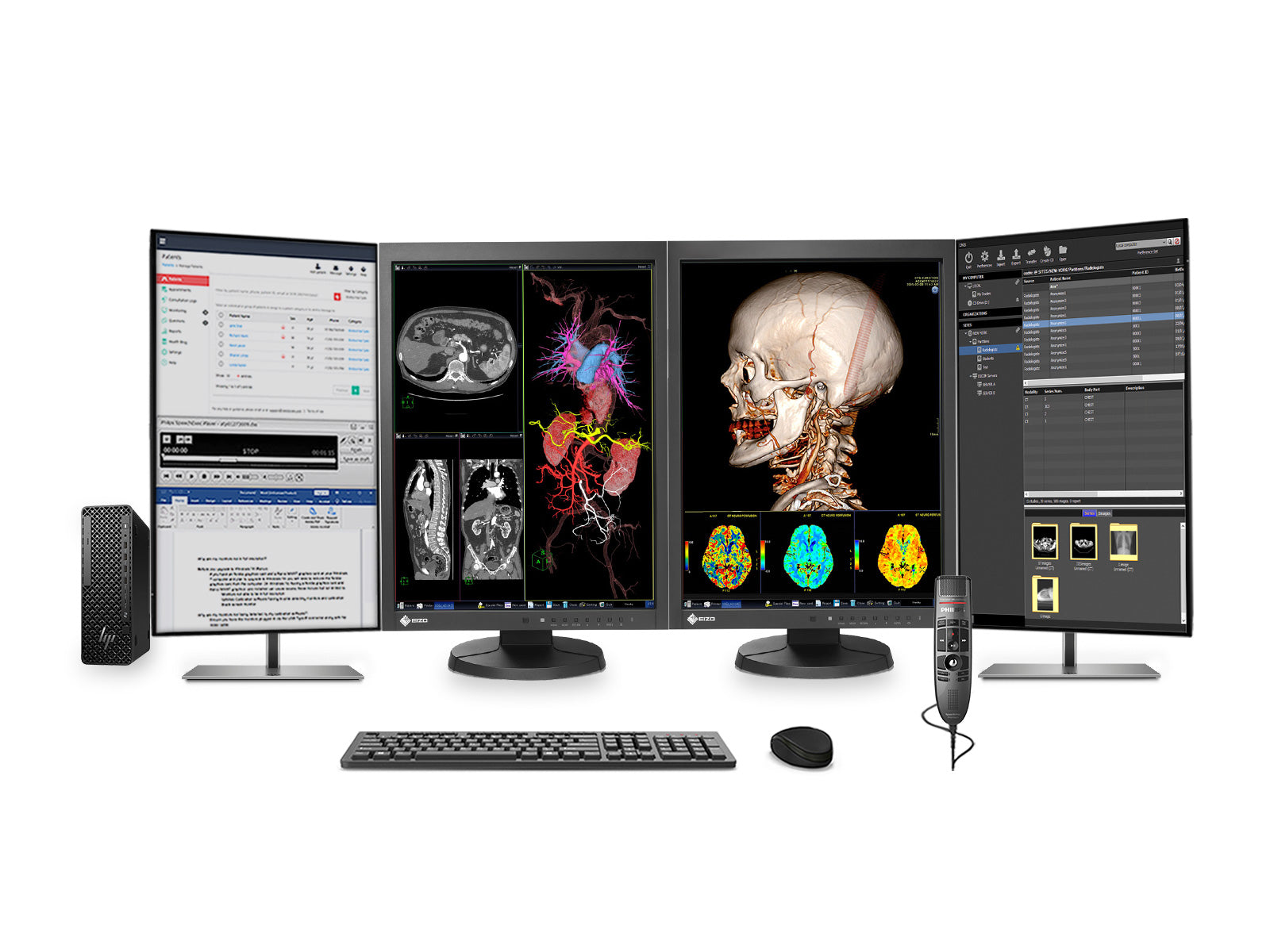 Complete PACS General Radiology Station | Eizo Radiforce MX215 2MP Color LED Displays | Business Class Workstation | Dictation Mic | Worklist Monitor (MX215Z2SFFG1i)