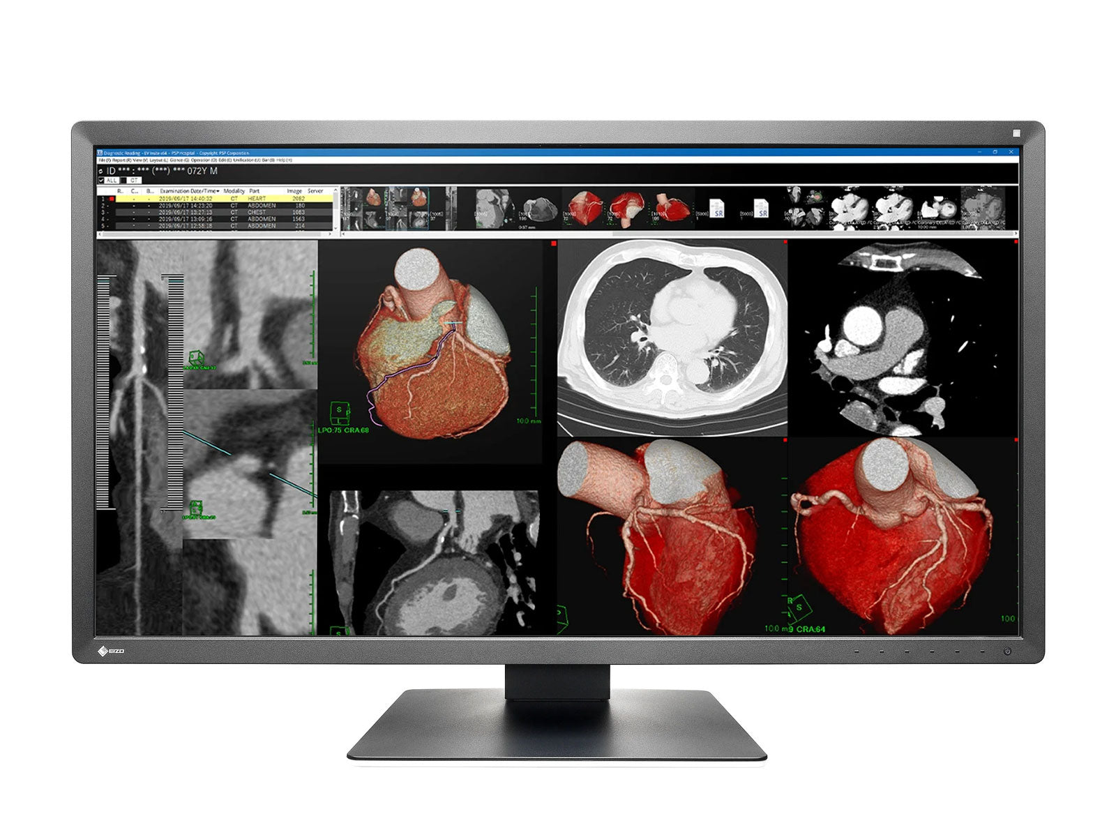 Eizo RadiForce MX317W Monitor de pantalla de revisión clínica en color de 8 MP y 30.5 "(MX317W-BK)