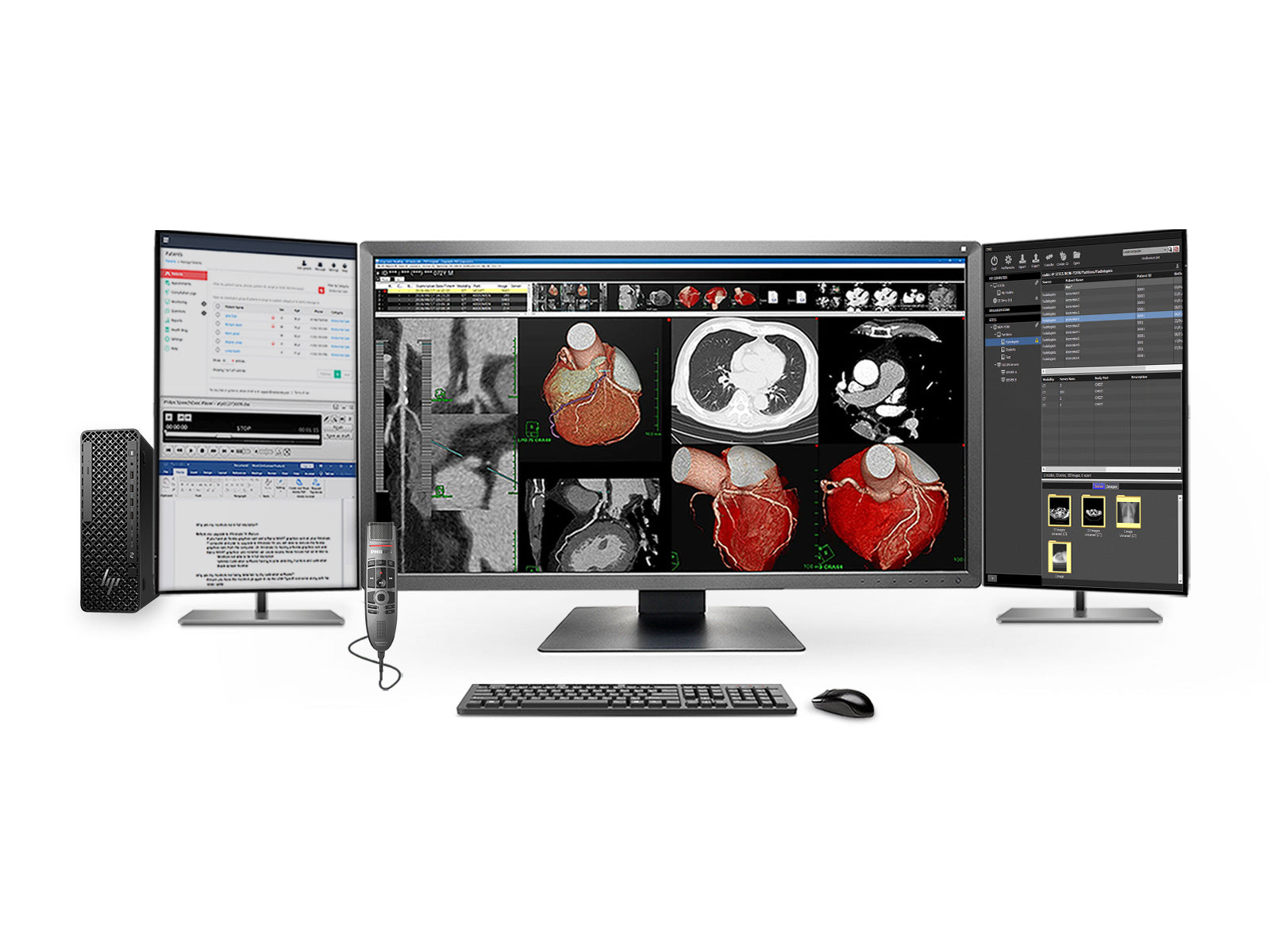 Complete PACS General Radiology Station | Eizo Radiforce MX317W 8MP Color Displays | Business Class Workstation | Dictation Mic | Worklist Monitor (MX317WZ4G5)