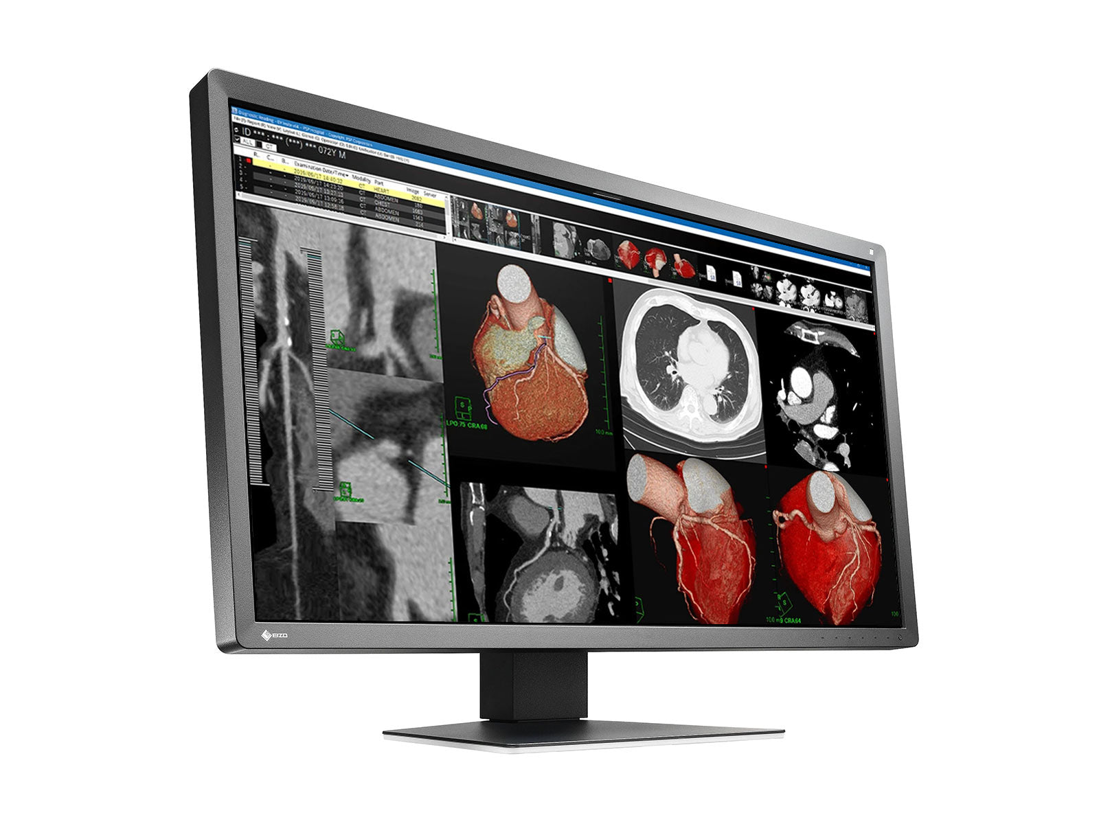 Moniteur d’examen clinique couleur 8MP 8MP 30" RadiForce MX317W (MX317W-BK)