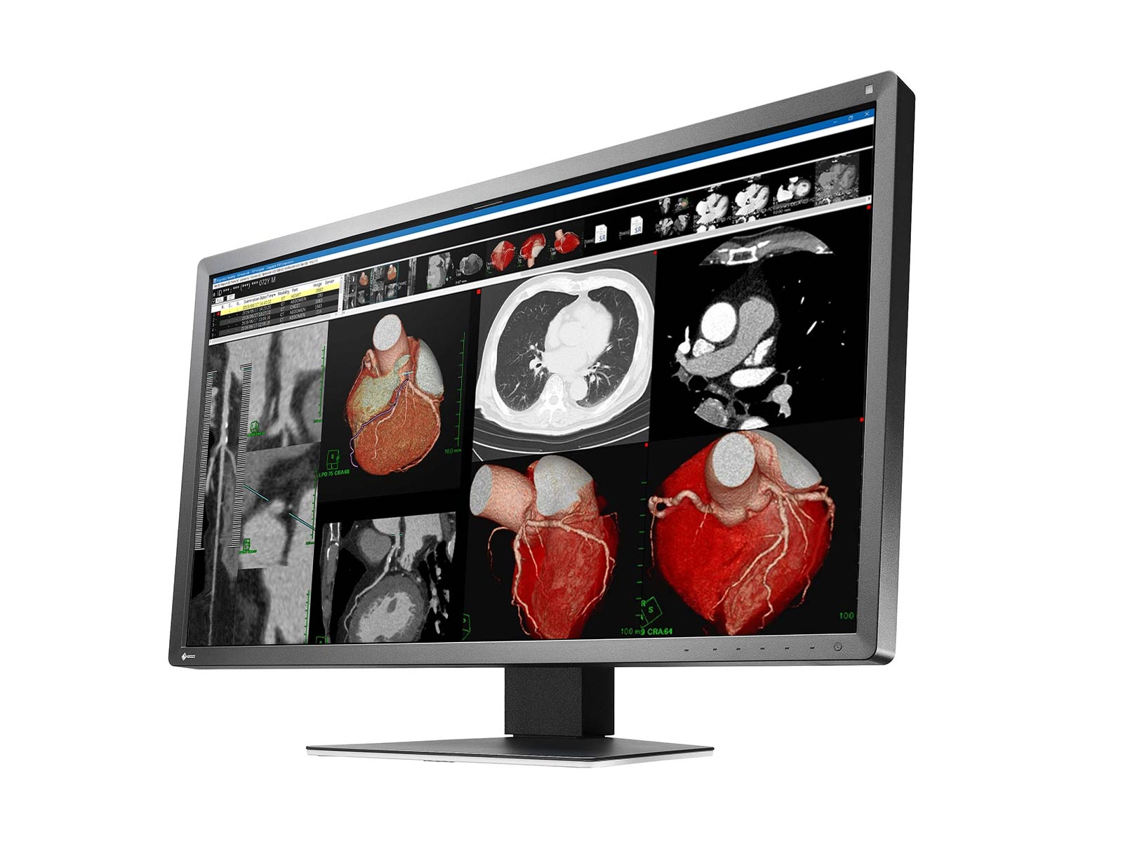 Moniteur d’examen clinique couleur 8MP 8MP 30" RadiForce MX317W (MX317W-BK)