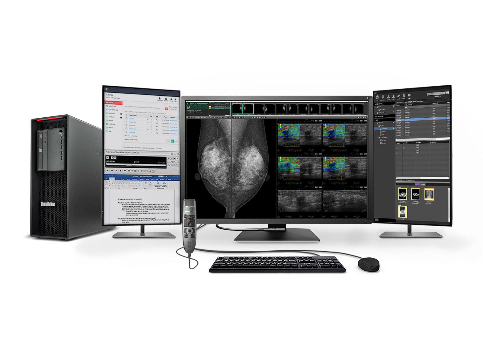 Complete Mammography Reading Station | Eizo 12MP Color Display | Lenovo Workstation | Dictation Mic | Worklist Monitors (RX1270P520)