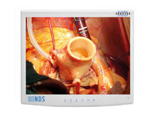 NDS EndoVue 19" BC-SX19-N1418 Monitor LCD Chirurgico per Endoscopia SXGA