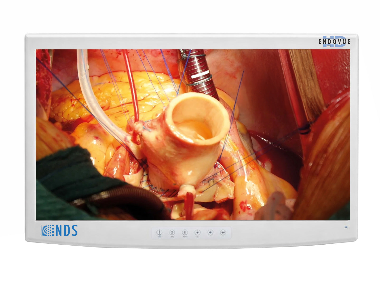 NDS EndoVue 19" BC-SX19-N1418 SXGA Value Surgical Endoscopy LCD Display Monitor