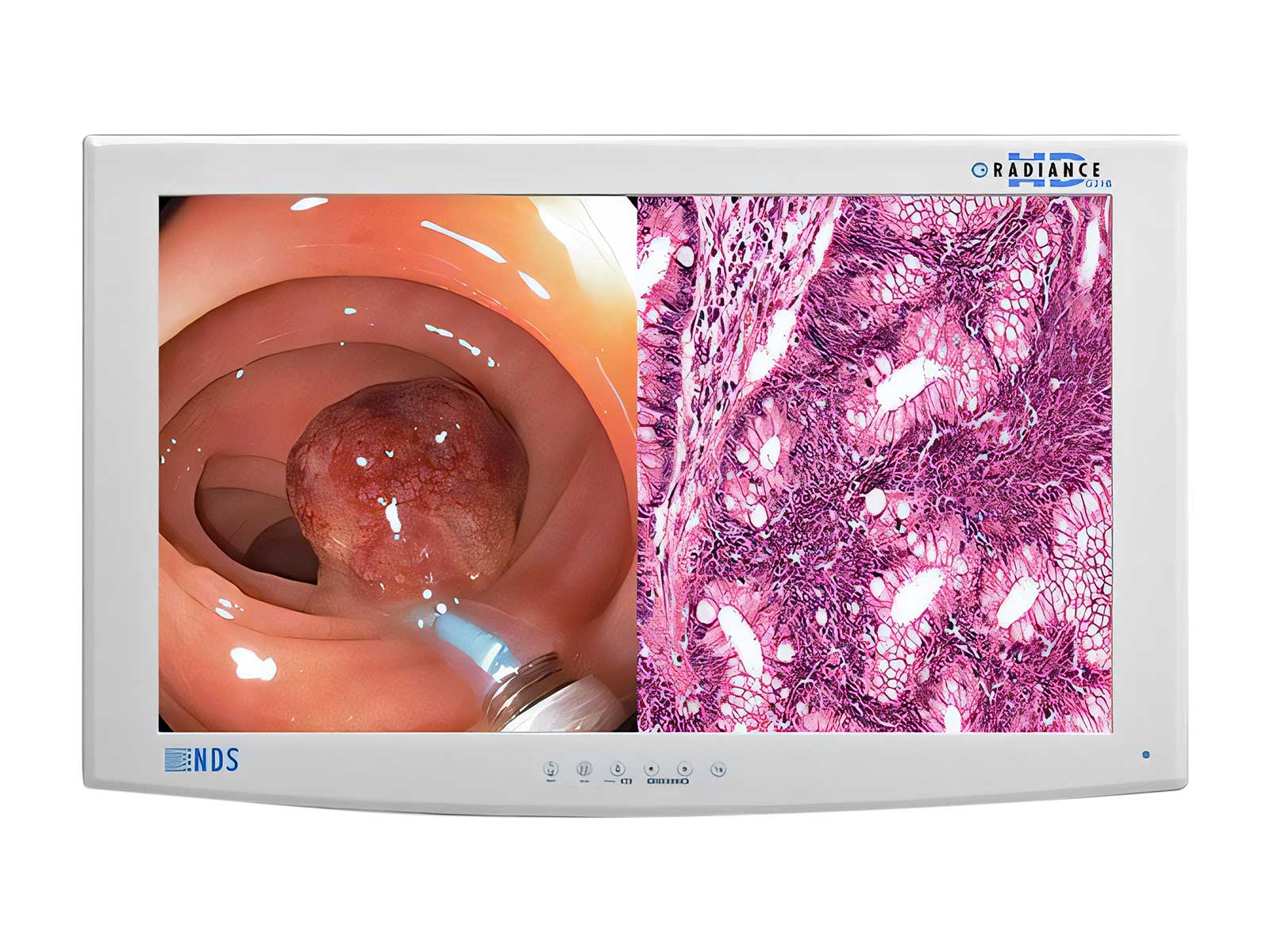NDS Radiance SC-WX32-A1511 32" Full HD Surgical Medical Display Monitor (SC-WX32-A1511)