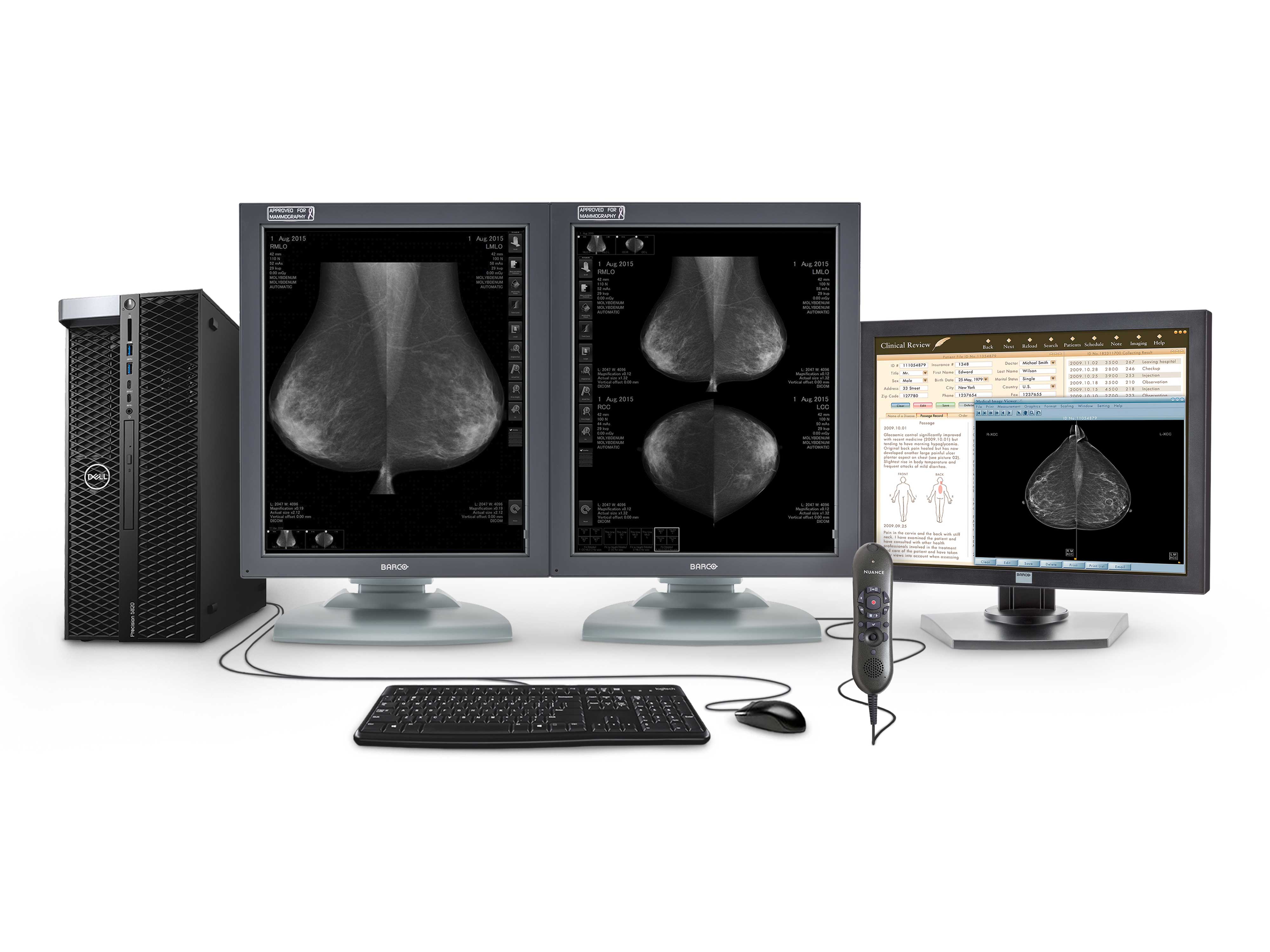 Estación completa de lectura de mamografía | Barco Pantallas en escala de grises de 5MP | Estación de trabajo Dell | Micrófono de dictado | Monitor de lista de trabajo (5121T5820R)