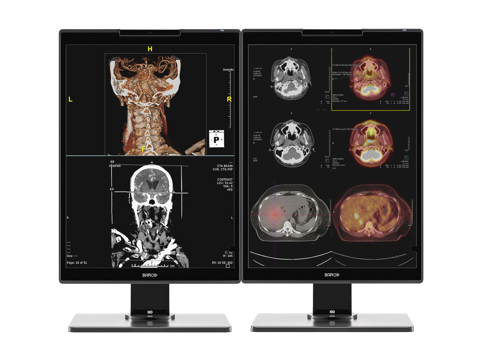Komplette PACS-Station für allgemeine Radiologie | Barco 3MP Farb-LED MDNC-3521 | HP Z4 G5 Workstation | Diktiermikrofon | Arbeitsvorratsmonitor (3521Z4G5)