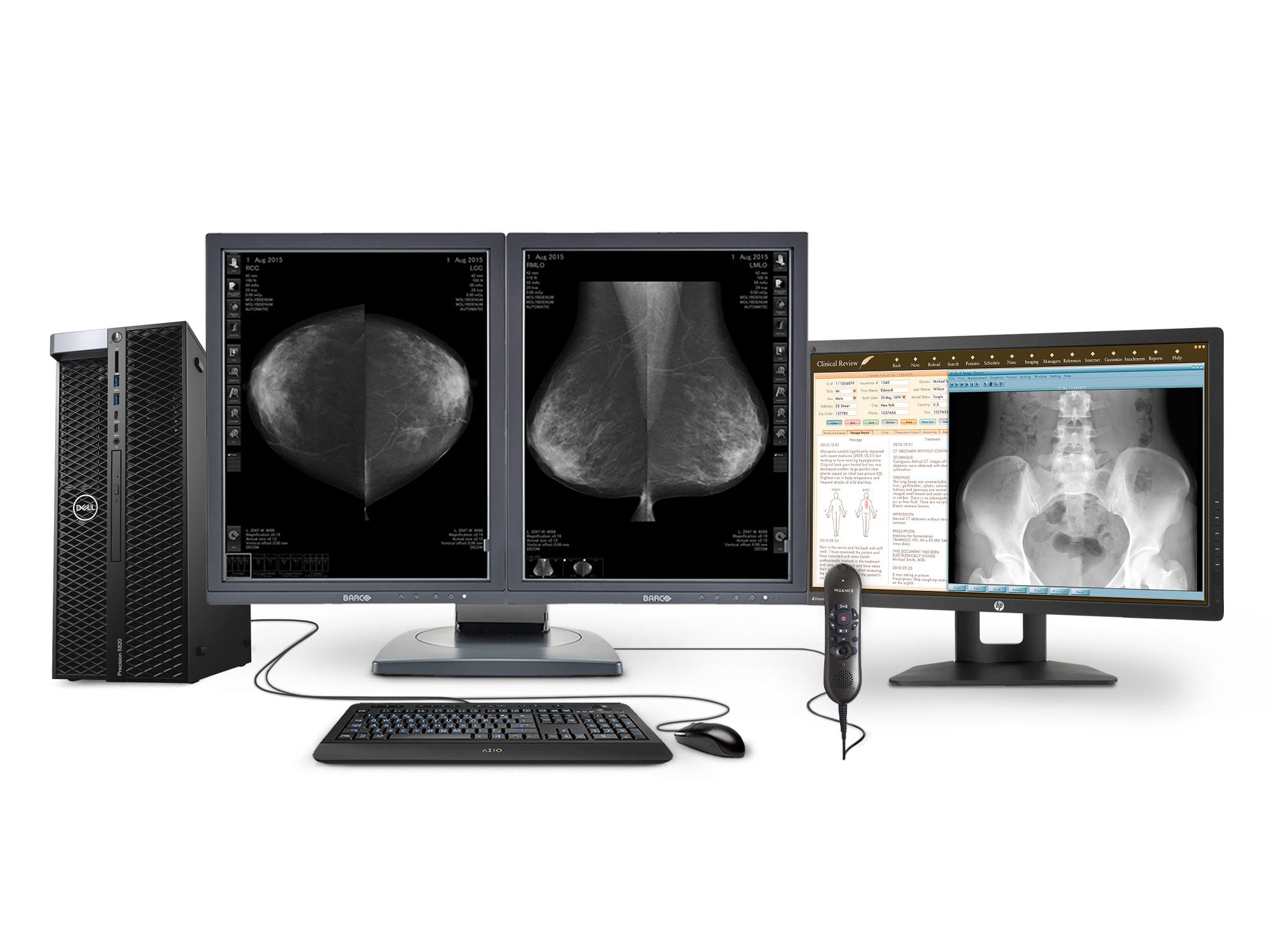 Estación completa de lectura de mamografía | Barco Pantallas 5D-DBT en escala de grises de 3 MP | Estación de trabajo Dell | Micrófono de dictado | Monitor de lista de trabajo (5121Z6R)