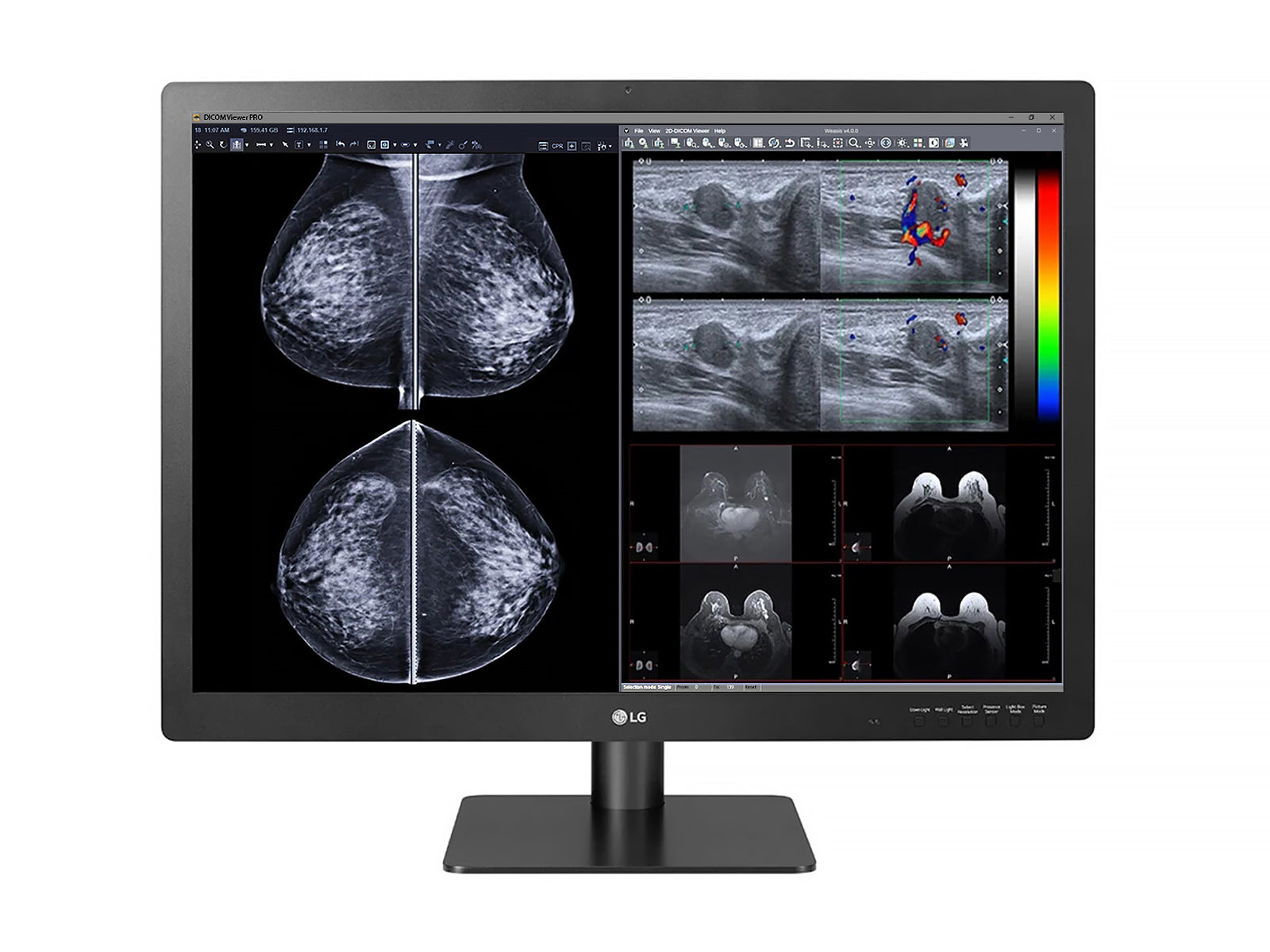 Eizo RadiForce RX440: 30