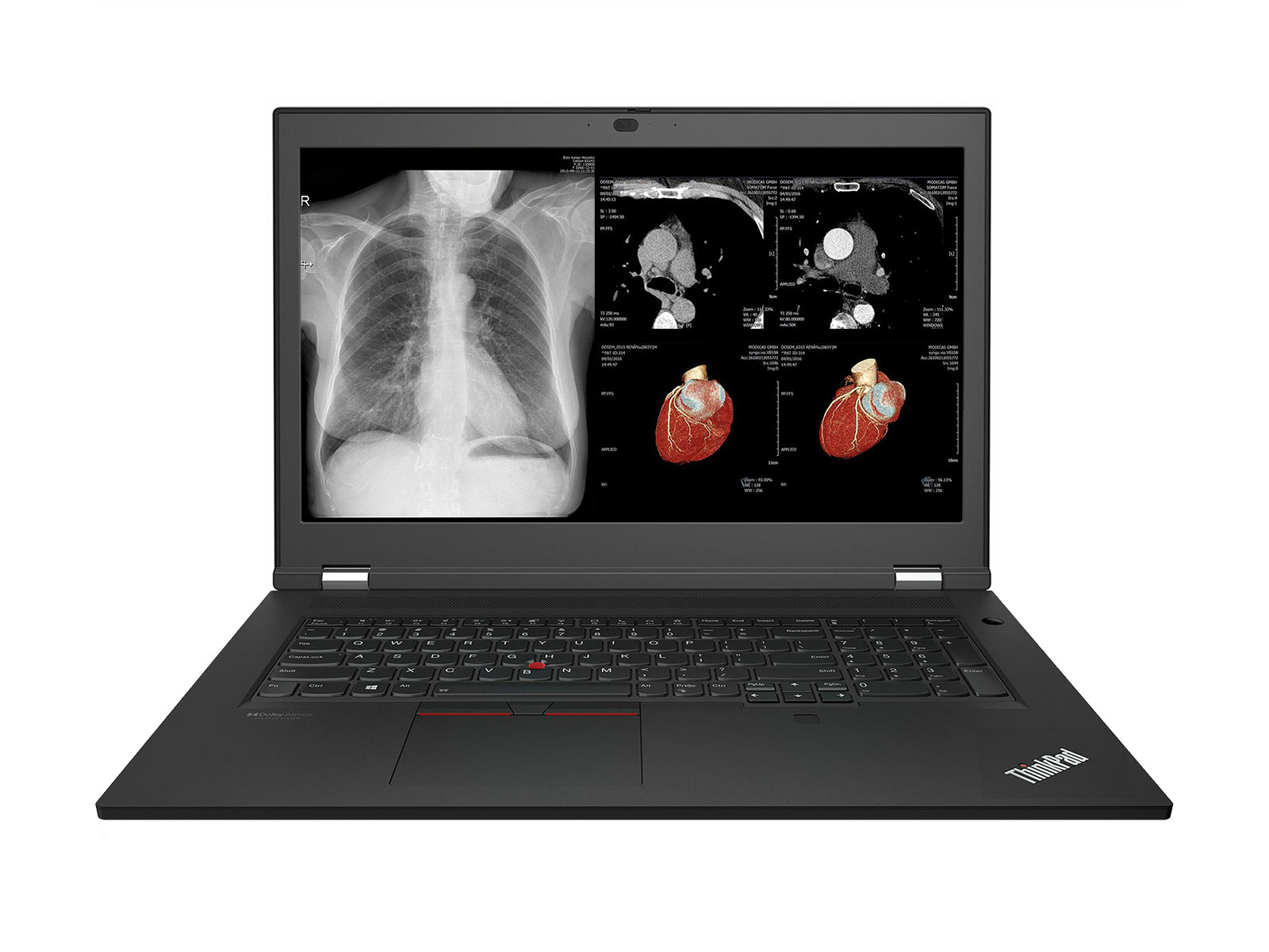 Lenovo ThinkPad P17 G2 Mobile Radiology Workstation | 17.3" 8MP DICOM Calibrated | Intel Core -i7-11850H @ 4.80GHz | 128GB DDR4 | 1TB NVMe SSD | NVIDIA RTX A5000 16GB | Win10 Pro Monitors.com 