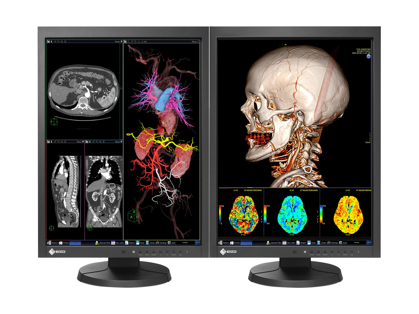 Eizo RadiForce MX215 2MP 21" Color Clinical Review Display Monitor (MX215-BK)