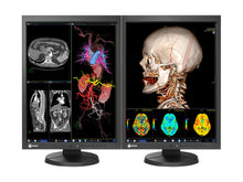 Eizo RadiForce MX215 2MP Monitor de Revisión Clínica a Color de 21" (MX215-BK)
