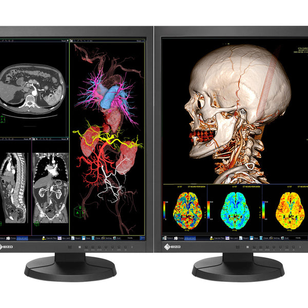 K様線　EIZO RadiForce MX215 医療用 モニター2台セット Eizo RadiForce MX215 2MP Écran pour examen clinique 21