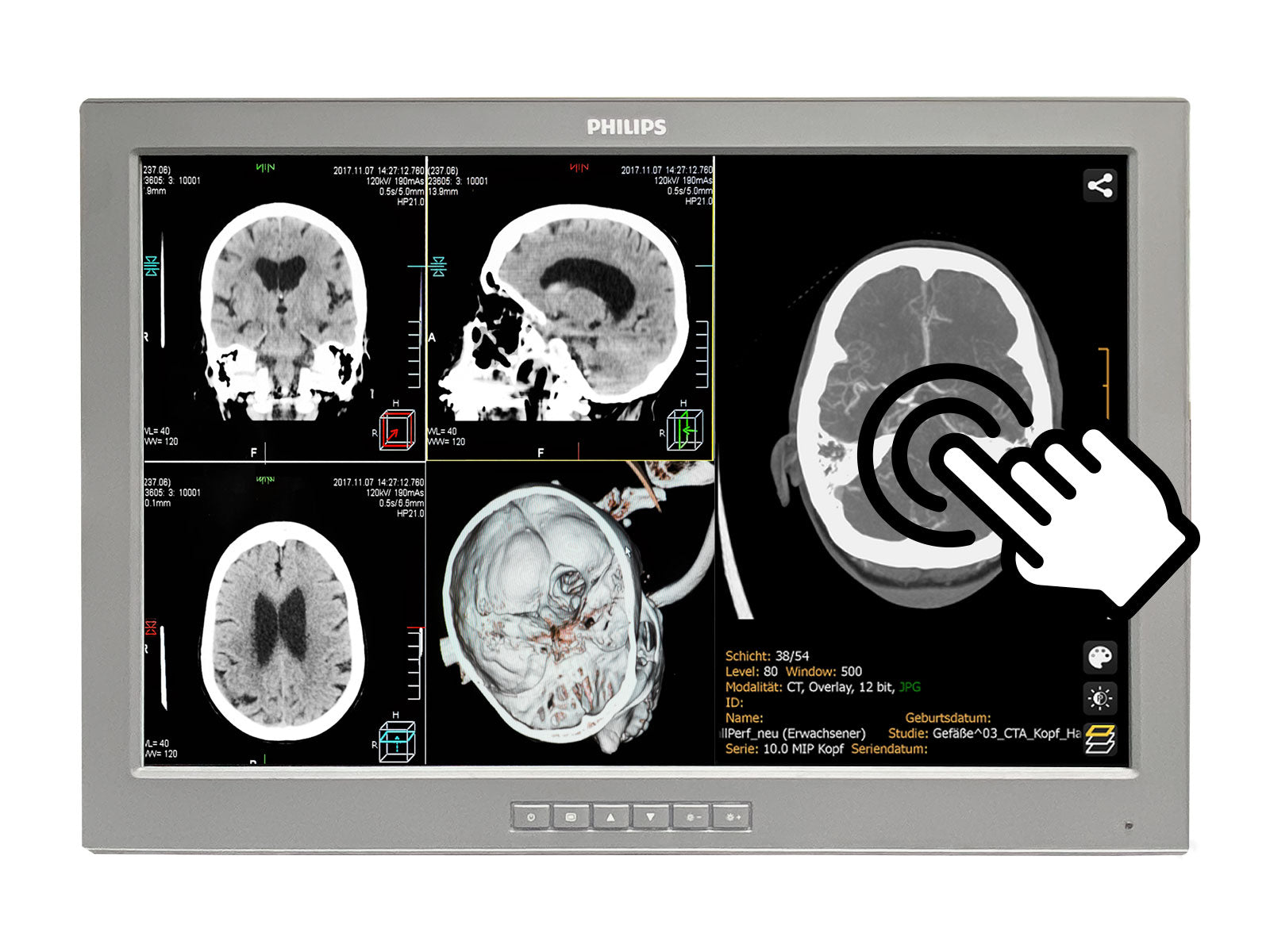Barco P240-LTv Touchscreen MED24ESB 24" WUXGA 1920 x 1200 2MP Philips DICOM Clinical Review Monitor by Fimi Barco (P240-LTv)