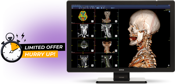 NEW Barco® Coronis Fusion 6MP with Protective Glass!
