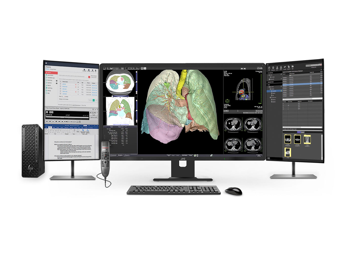 JVC CL-R813 8MP PACS General Radiology Workstation Overview