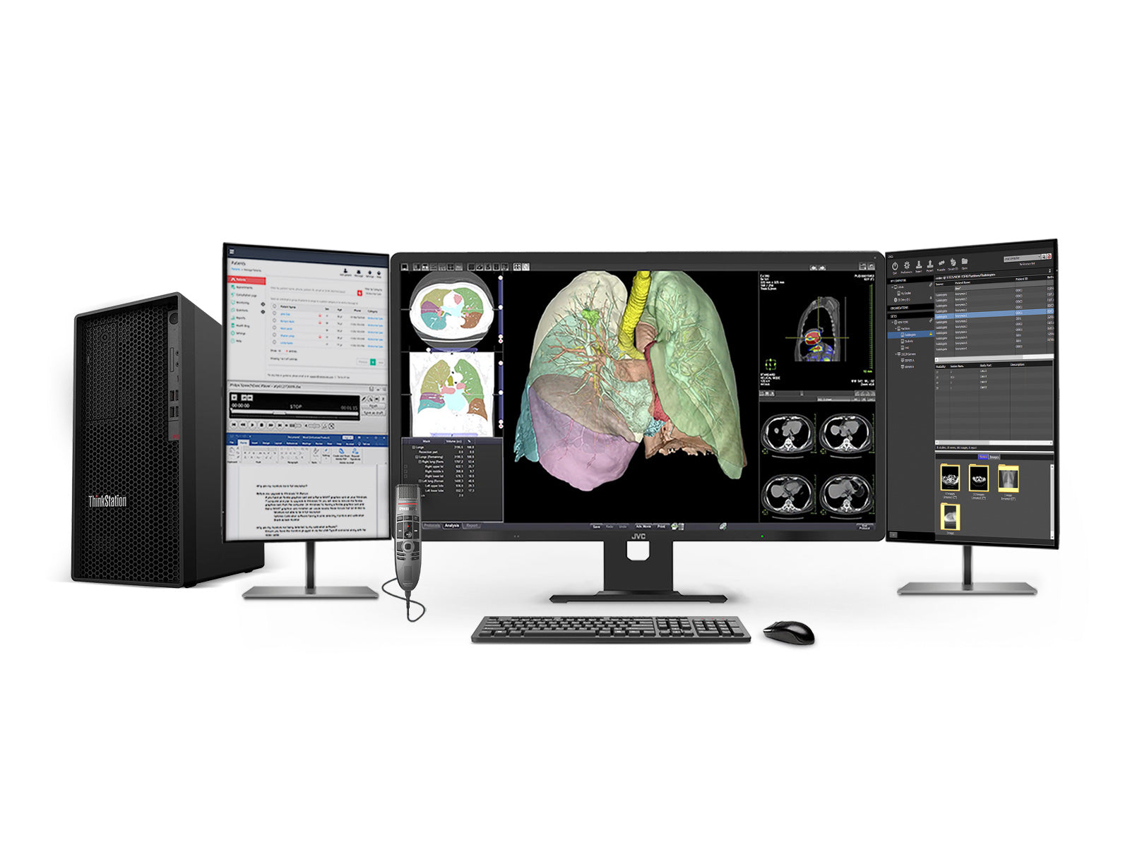 Complete PACS General Radiology Station | JVC CL-R813 8MP Color Display | Business Class Workstation | Dictation Mic | Worklist Monitor (R813Z4G5)