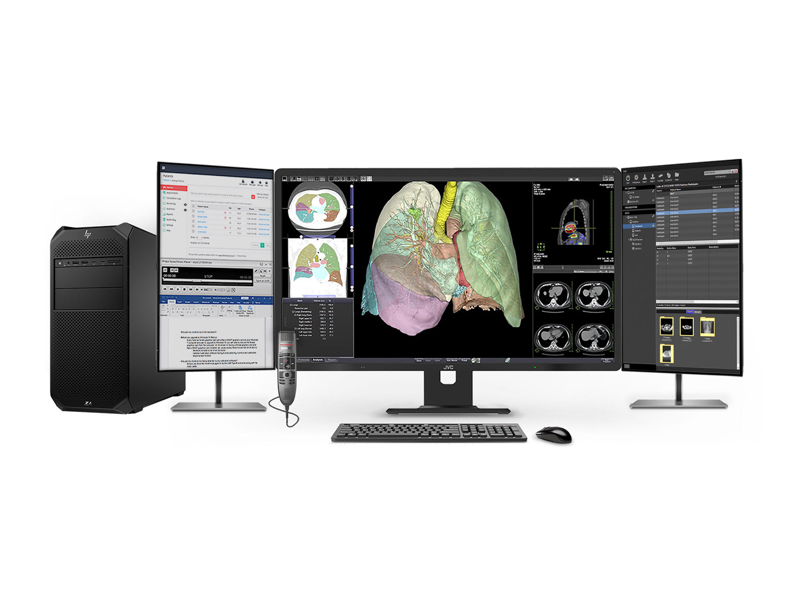 Complete PACS General Radiology Station | JVC CL-R813 8MP Color Display | HP Z4 G5 Workstation | Dictation Mic | Worklist Monitor (R813Z4G5)
