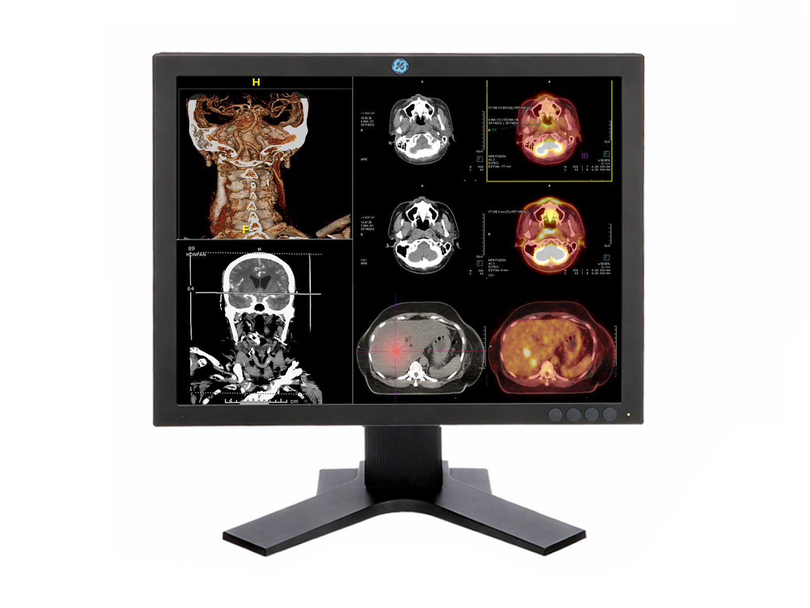 Eizo Monitor de Revisión Clínica de Color GE RS150-S