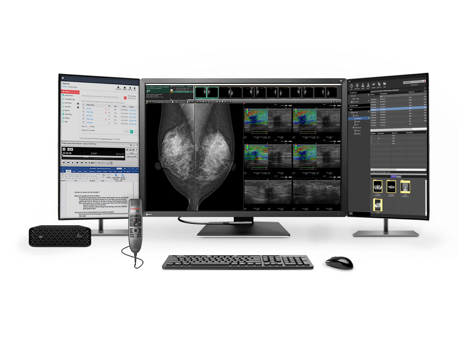Complete Mammography Reading Station | Eizo Radiforce RX1270 12MP Color Mammo Monitor | HP Z2 Mini G9 Workstation | Dictation Mic | Worklist Monitors (RX1270Z2MNG9)