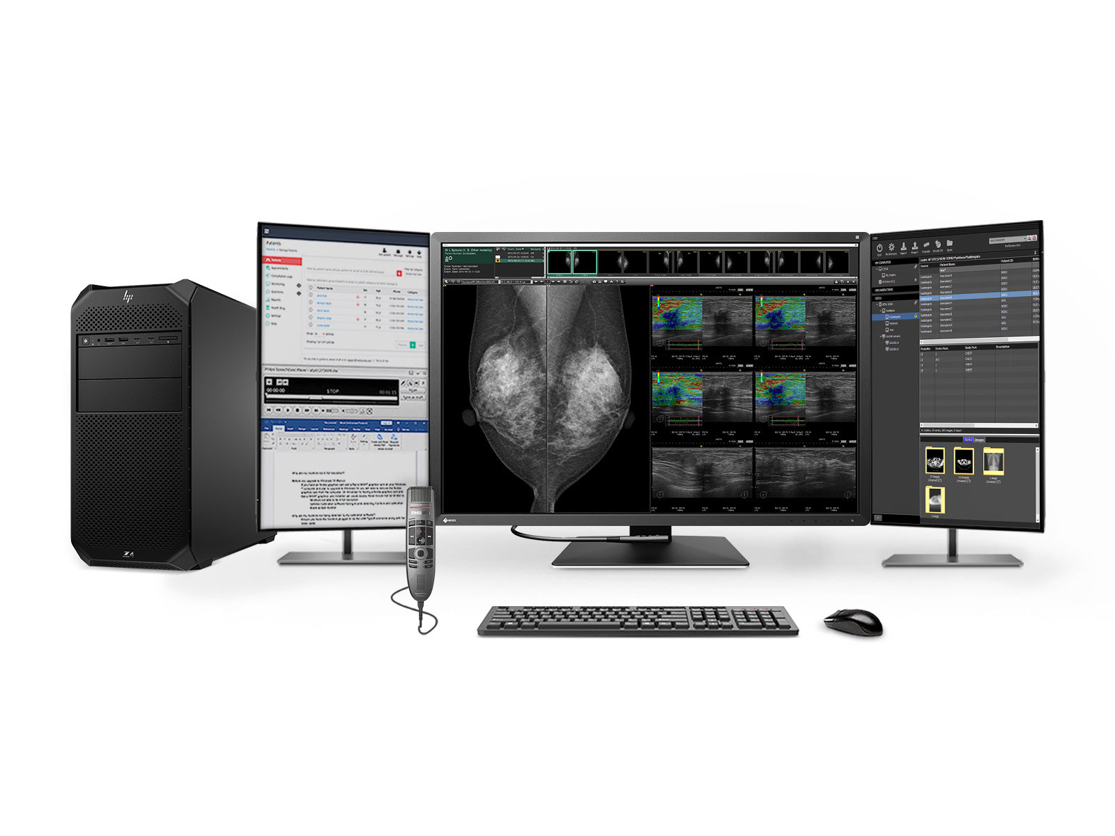 Stazione di lettura mammografica completa | Eizo Radiforce RX1270 12MP Monitor Mammo a colori | HP Z4 G5 Workstation | Microfono di dettatura | Monitor della lista di lavoro (RX1270Z4G5) 